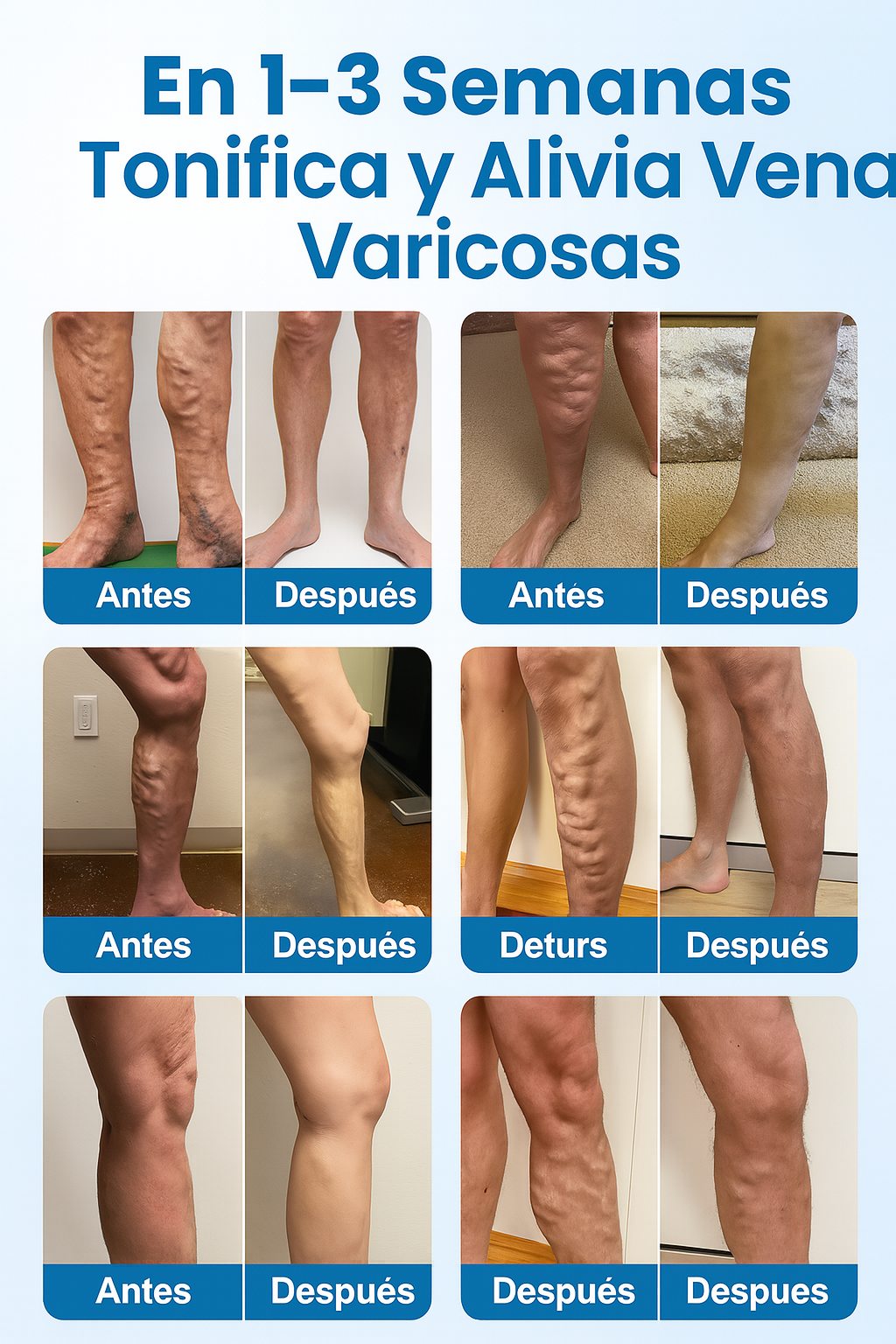 Spray Herbal Antivárices VeinGuard® – Refresca tus piernas y mejora su apariencia